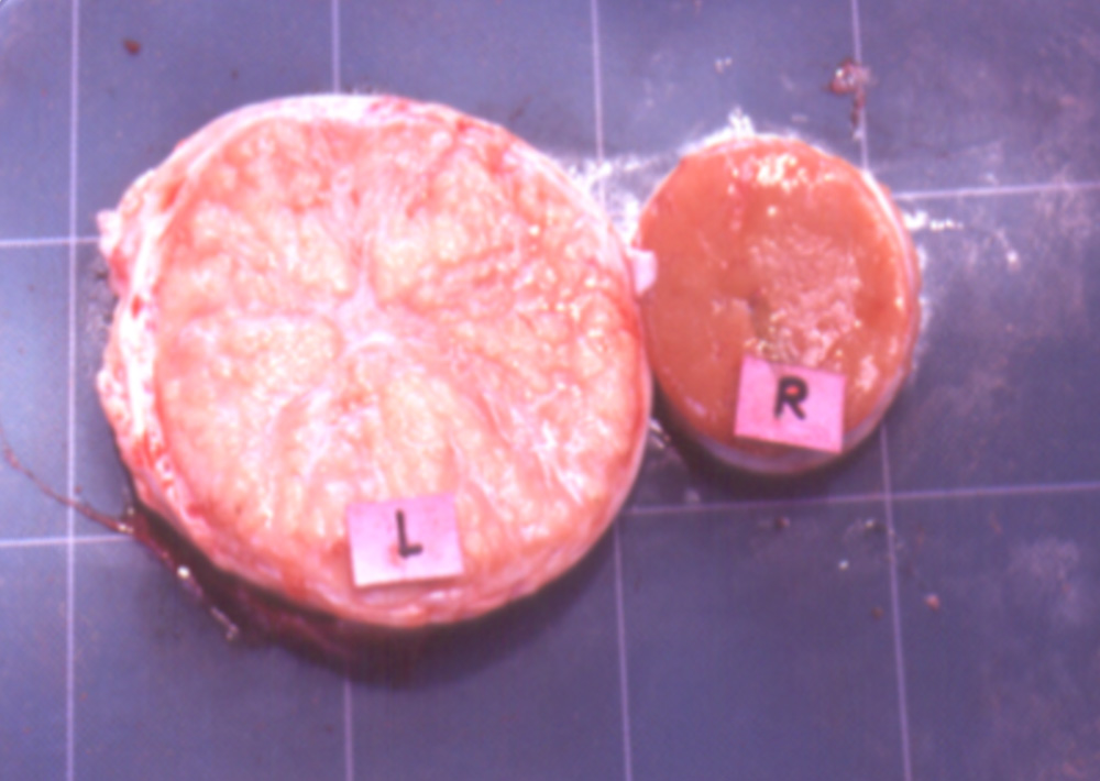 Cross section of bovine-brucellosis-infected bovine testicles 