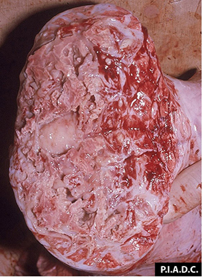 Bovine, lung. Dull, tan parenchyma, containing multiple necrotic cavities, partially surrounded by a fibrous capsule (sequestrum). Interlobular septa surrounding the sequestrum are markedly thickened by fibrous tissue. 