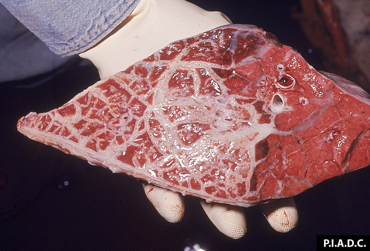 Bovine, lung. with interlobular septa and pleura markedly thickened with fibrous tissue in the ventral portion of the lung (left), sharply demarcated from normal tissue dorsally (right). 