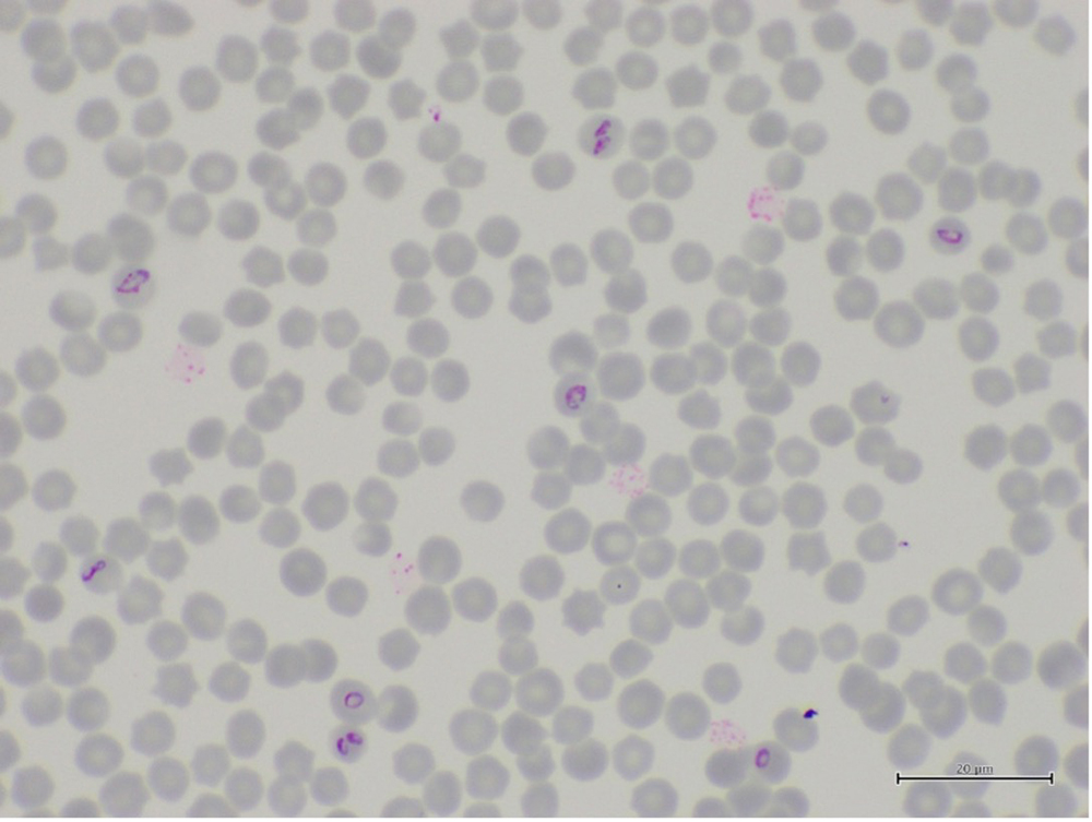 Microscopic images of Babesia caballi within erythrocytes