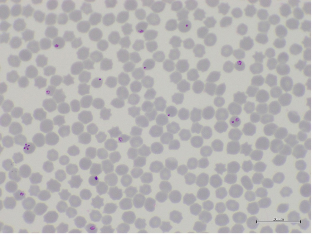 Microscopic images of Theileria equi within erythrocytes