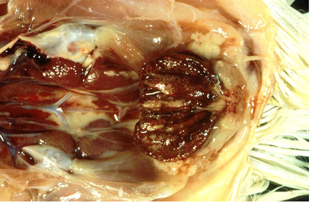 Bisected bursa with haemorrhage and inflammation